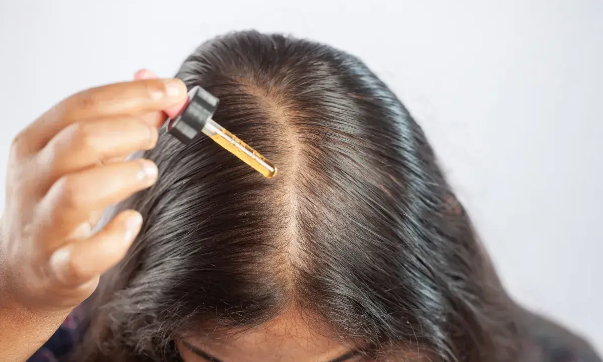 Una mano applica olio di ricino sul cuoio capelluto, sfruttando i benefici per capelli più forti e sani.