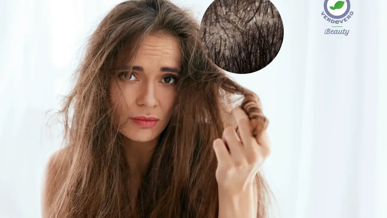 Ragazza con capelli spenti e cute grassa, preoccupata per la salute dei suoi capelli.
