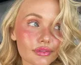 Viso di donna con pelle luminosa e rosata, labbra lucide. L'acido lattico a cosa serve? A donare idratazione e un aspetto radioso.