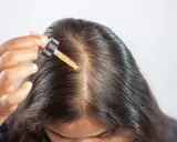 Una mano applica olio di ricino sul cuoio capelluto, sfruttando i benefici per capelli più forti e sani.