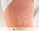 Pelle che si desquama dopo un'esposizione solare. Scopri come togliere la pelle morta dal corpo in modo delicato.
