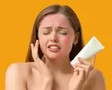 Donna con viso arrossato dal sole, tiene in mano un tubetto bianco, cercando sollievo. Cosa mettere sulle scottature per lenire la pelle.