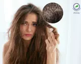 Ragazza con capelli spenti e cute grassa, preoccupata per la salute dei suoi capelli.