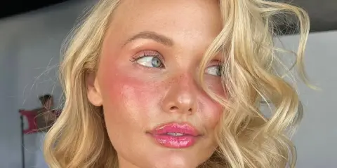 Viso di donna con pelle luminosa e rosata, labbra lucide. L'acido lattico a cosa serve? A donare idratazione e un aspetto radioso.