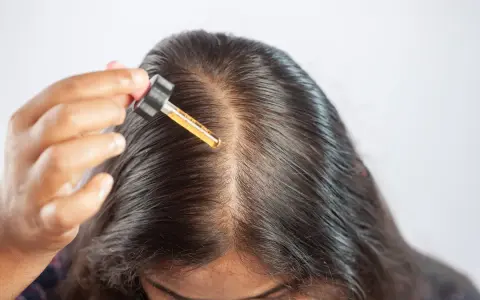 Una mano applica olio di ricino sul cuoio capelluto, sfruttando i benefici per capelli più forti e sani.