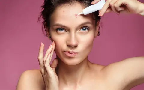 Donna applica tea tree oil su brufolo schiacciato sulla fronte.