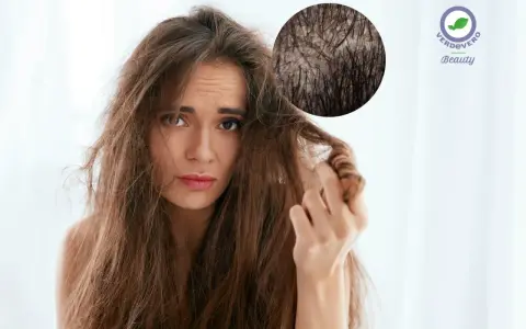 Ragazza con capelli spenti e cute grassa, preoccupata per la salute dei suoi capelli.