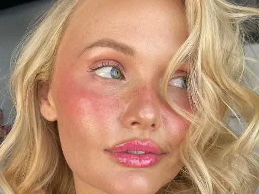 Viso di donna con pelle luminosa e rosata, labbra lucide. L'acido lattico a cosa serve? A donare idratazione e un aspetto radioso.