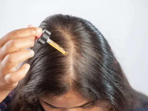 Una mano applica olio di ricino sul cuoio capelluto, sfruttando i benefici per capelli più forti e sani.