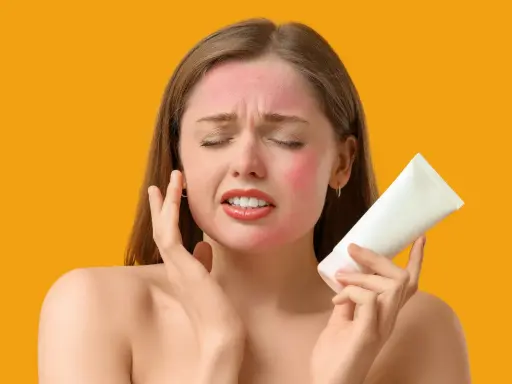 Donna con viso arrossato dal sole, tiene in mano un tubetto bianco, cercando sollievo. Cosa mettere sulle scottature per lenire la pelle.