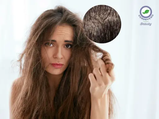 Ragazza con capelli spenti e cute grassa, preoccupata per la salute dei suoi capelli.