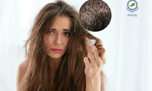 Ragazza con capelli spenti e cute grassa, preoccupata per la salute dei suoi capelli.