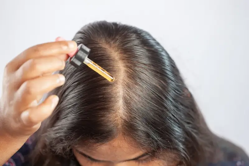 Una mano applica olio di ricino sul cuoio capelluto, sfruttando i benefici per capelli più forti e sani.